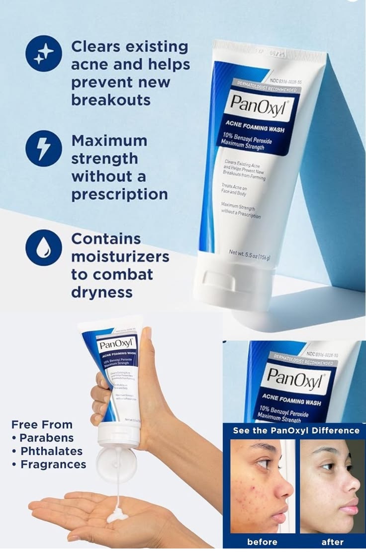 PanOxyl Acne Foaming Wash | Acne & Breakout Cleanser